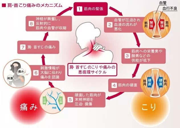 キャッチアイ - 画像 (10)