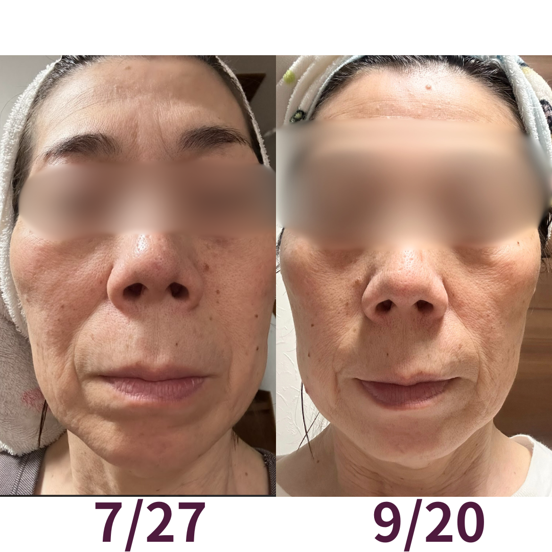 SUPERELASTINPLUS 3個セット(からだを知る冊子付) - 画像 (2)