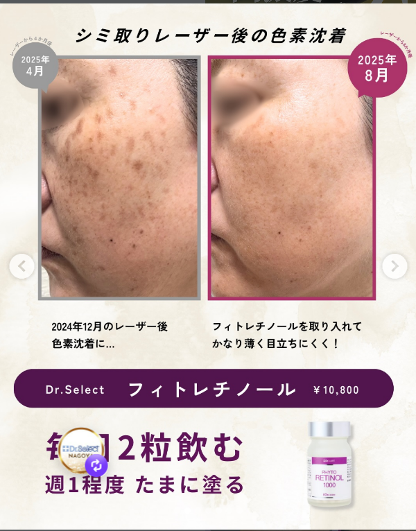 削らず、急がず、肌を育てる。 敏感肌のためのフィトレチノール習慣セット - 画像 (6)