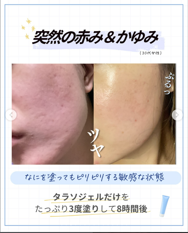 削らず、急がず、肌を育てる。 敏感肌のためのフィトレチノール習慣セット - 画像 (8)