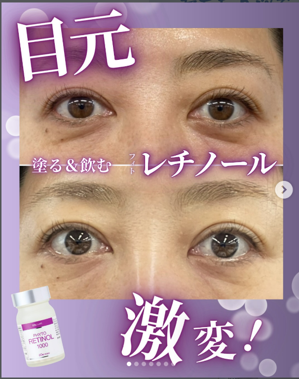 削らず、急がず、肌を育てる。 敏感肌のためのフィトレチノール習慣セット - 画像 (5)